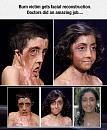 Click image for larger version

Name:	cool-burnt-victim-facial-reconstruction-7703d.jpg
Views:	0
Size:	89.4 KB
ID:	771264