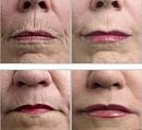 Click image for larger version

Name:	wrinkle-remover.jpg
Views:	0
Size:	20.2 KB
ID:	817361