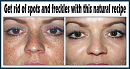 Click image for larger version

Name:	Get-Rid-Of-Spots-And-Freckles-With-This-Natural-Recipe-Made-From-Only-2-Ingredients.png
Views:	0
Size:	196.0 KB
ID:	761129